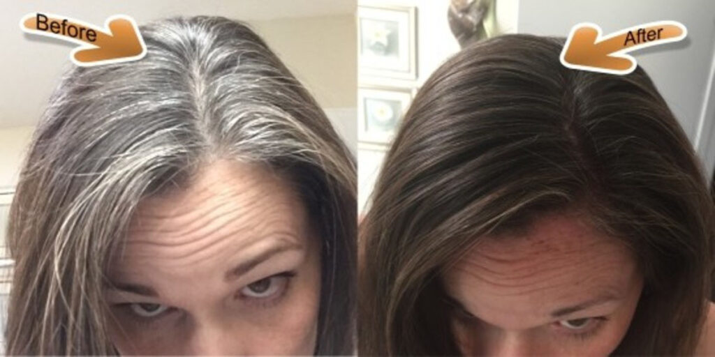 Grey hair Before After